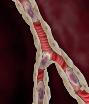 Capillary constriction continues post-PCI